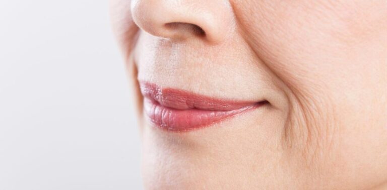 How To Conceal Wrinkles Around The Mouth