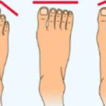 Shape Of Your Feet