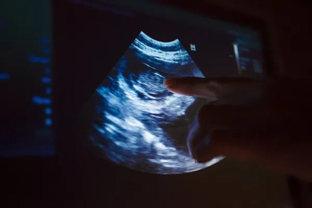 ultrasound