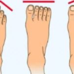 the Shape of Your Feet